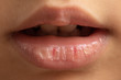 © Alessandro Grandini - natural remedies for chapped lips at a young age, concept of skin care
