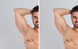 © New Africa - Collage of man showing armpit before and after epilation on light grey background