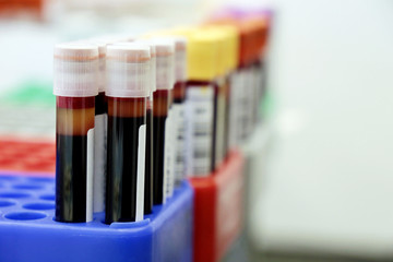 Vials of blood in the medical laboratory. Concept of blood test, donation, research, health care