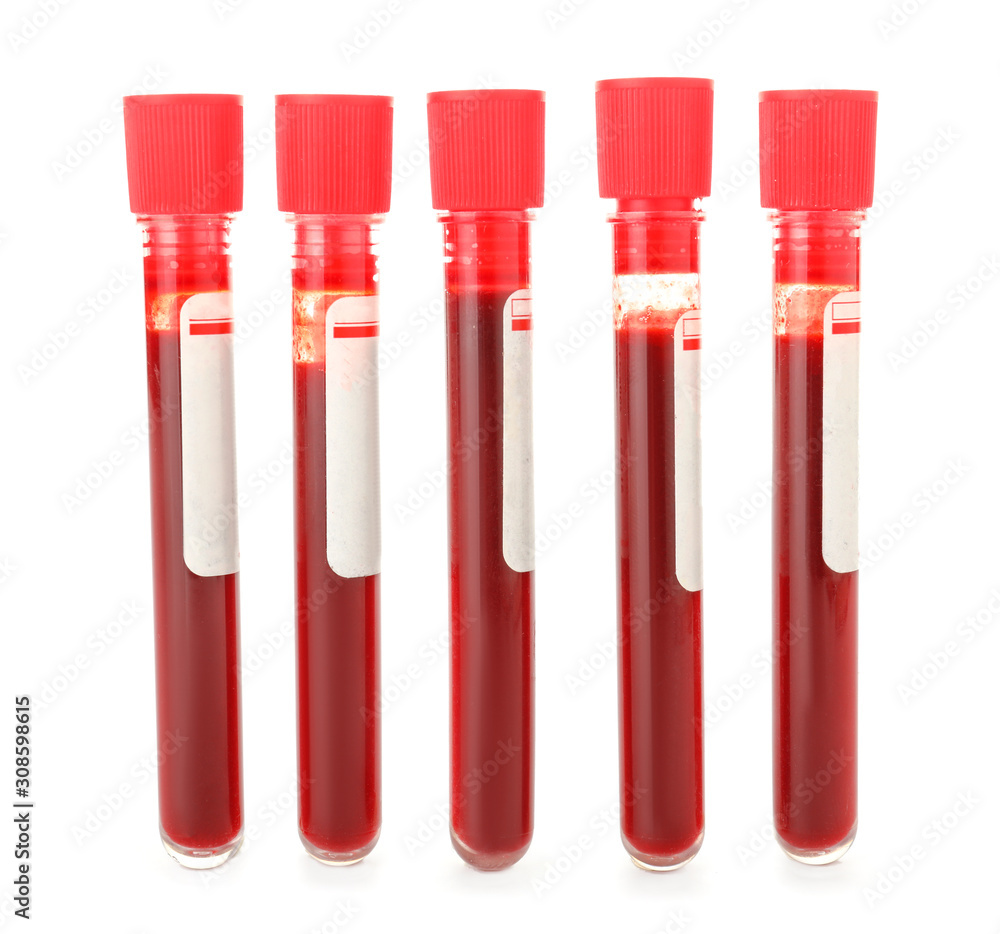 Test tubes with blood on white background