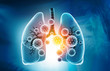 Viral lung infections, lung infection conept. 3d illustration.