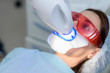 © johnalexandr - the patient undergoes a procedure for teeth whitening with an ultraviolet lamp
