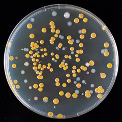 Canvas Print - Agar culture of various bacteria on agar in a Petri dish