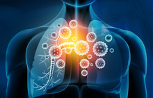 Viral Lung Infections, Lung Infection Conept. 3d Illustration.
