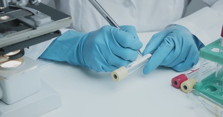 Wall Mural - close up shot of laboratory assistant signs pen test tubes to collect analysis and further research