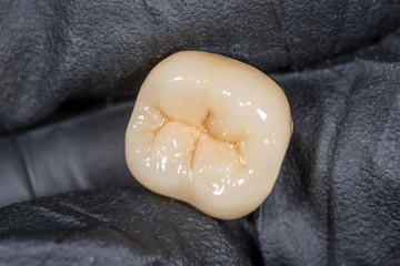 Wall Mural - ceramic tooth crown. Close-up macro of a prosthesis in the dentist's hand
