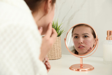 teen girl applying acne healing patch using mirror indoors