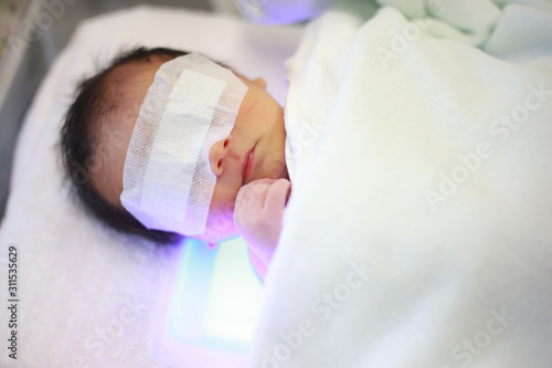 新生児黄疸の光線療法 Buy This Stock Photo And Explore Similar Images At Adobe Stock Adobe Stock 新生児黄疸の光線療法 Buy This Stock Photo And Explore Similar Images At Adobe Stock Adobe Stock