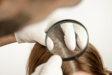 Doctor examining womans hair scalp, scalp eczema, dermatitis, psoriasis, hair loss, dandruff or dry scalp problem