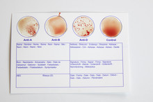 Home Blood Type Testing For Type A 