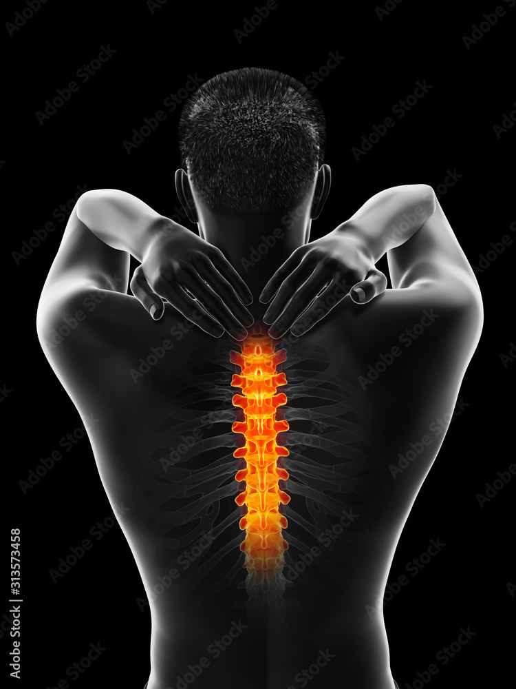 3d rendered medically accurate illustration of a man having a painful upper back - obrazy, fototapety, plakaty 