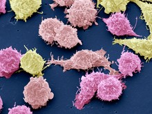 Cancer Cells, SEM