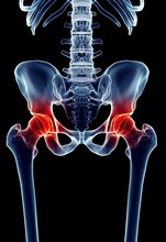 Pain Free Stock Photo - Public Domain Pictures