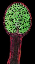 Liverwort Spore Capsule, LM