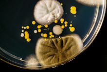 Mould And Bacteria On Petri Dish