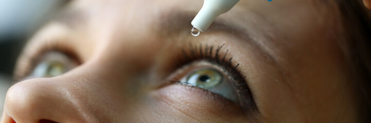 Wall Mural - Female putting liquid drops in her eye solving vision problem