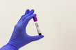 © MMM - A hand in a blunted latox glove holds a blood test tube on a white background with place for text. Copy space.