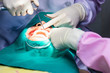 © kannapon - Dentist and nurse treating patient’s teeth.