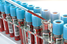 Blood Test Samples Tubes And Blood Test Pipette Adding Fluid To One Of Tubes In Medical Laboratory.