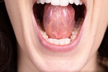 Detail of open female mouth with teeth and tongue in sight