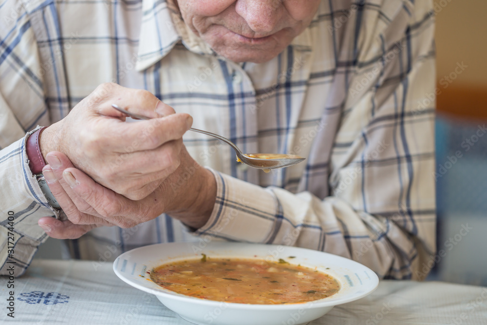 Elderly man with Parkinsons disease holds spoon in both hands - obrazy, fototapety, plakaty 