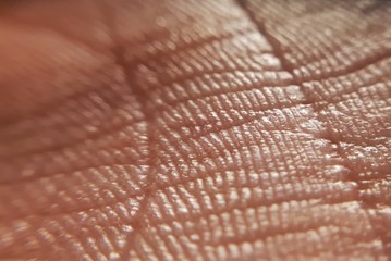 Wall Mural - skin psoriasis. Skin diseases concept. macro skin of human hand.Medicine and dermatology concept. Details of human skin background.