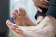 Pitted keratolysis is a bacterial skin infection on the feet