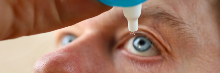 Canvas Print - Male hand putting liquid drops in his eye