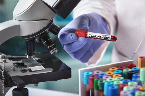 Cuadros en Lienzo doctor in the laboratory with a blood tube for analysis and sampling of Coronavi