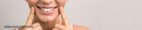 Fotomural closeup view of female wide cheerful smile with white teeth and clean skin and c