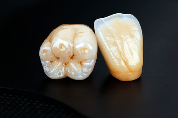 dental ceramic crowns, natural color effects