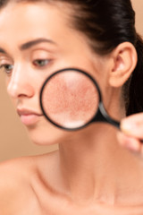 selective focus of man holding magnifier near naked woman with problem skin isolated on beige