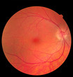 Ophthalmic image detailing the retina and optic nerve inside a healthy human eye. Medicine concept