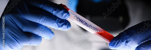 Fotomural Male chemist hand in blue protective gloves hold test tube closeup background