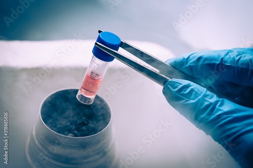 Fotomural Liquid Nitrogen bank containing suspension of stem cells