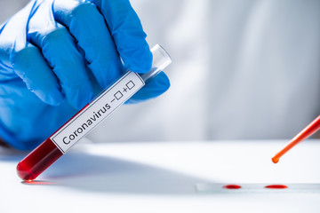 Laboratory assistant tests blood for new coronavirus from China 2019-nCoV