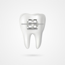 Vector Tooth Braces Illustration 3d Style