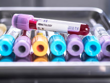Human Blood Samples Awaiting Screening In Lab