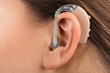 A girl with a hearing aid. The girl assumes hearing aid. Happy girl that hears well again. Hearing aid close up. 