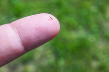 A Splinter In The Finger Close Up.