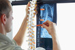Comparative analysis of spine  - model and x-ray photo. Diagnosos, treatment planning.