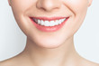© Aleksandr Rybalko - Perfect healthy teeth smile of a young woman. Teeth whitening. Dental clinic patient. Image symbolizes oral care dentistry, stomatology. Dentistry image.