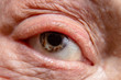 © Svyatoslav Balan - The blue eye of an old man with many brown specks on the iris.