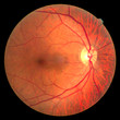 Human eye anatomy taking images with Mydriatic Retinal cameras