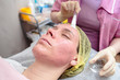 © koldunova - Cosmetologist uses a brush to apply a soothing, transparent mask to the reddened skin of the patient's face, after chemical peeling.