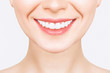 © Aleksandr Rybalko - Perfect healthy teeth smile of a young woman. Teeth whitening. Dental clinic patient. Image symbolizes oral care dentistry, stomatology. Dentistry image.