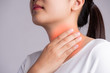 © Siam - Sore Throat. Closeup Of Beautiful Young Woman Hand Touching Her Ill Neck. Healthcare and medical concept.