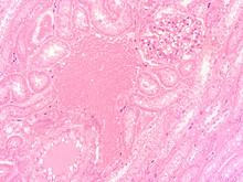 Picture Of Histology Human Tissue With Microscope From Laboratory (not Illustration Designation)