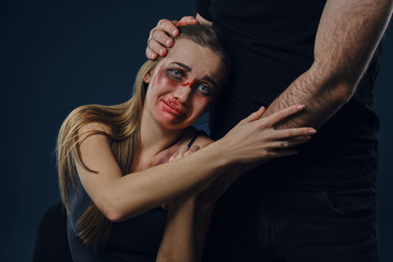 Man put his hand on female head, like hugging. They holding hands. Victim with bruises sitting nearby. Blue background. Domestic violence. Close-up.