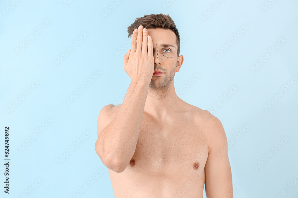 Young man with marks on his face against color background. Concept of plastic surgery